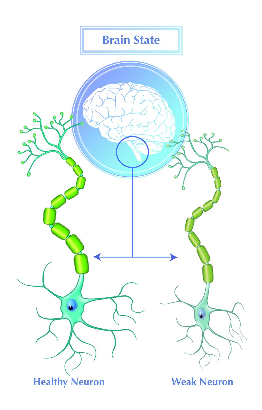 Brain state: a healthy neuron compared with a weak neuron