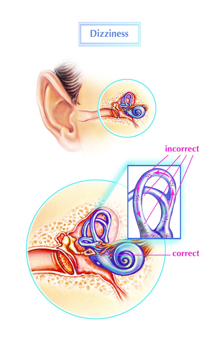 Dizziness: the inner ear and balance system